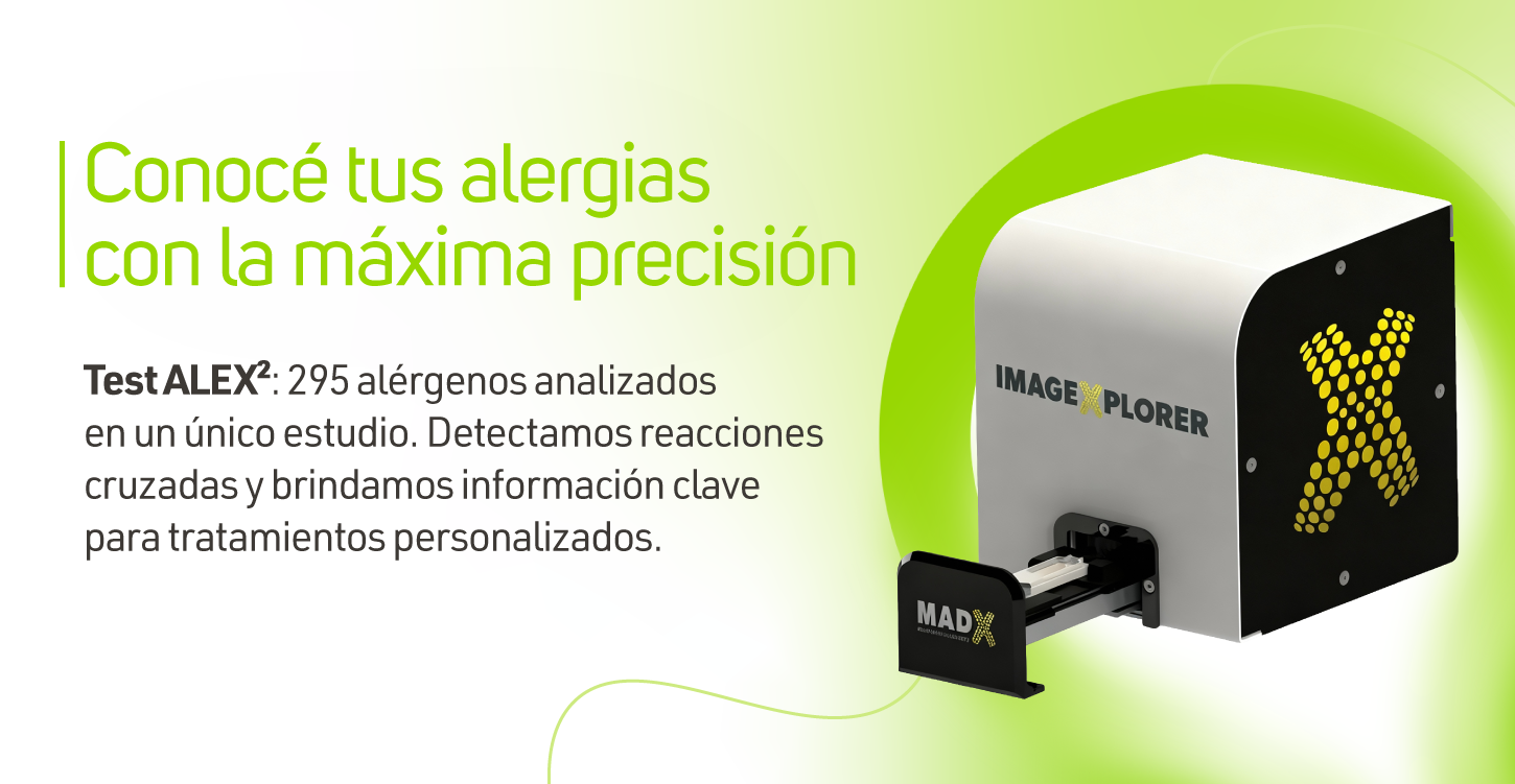 slide alergias test